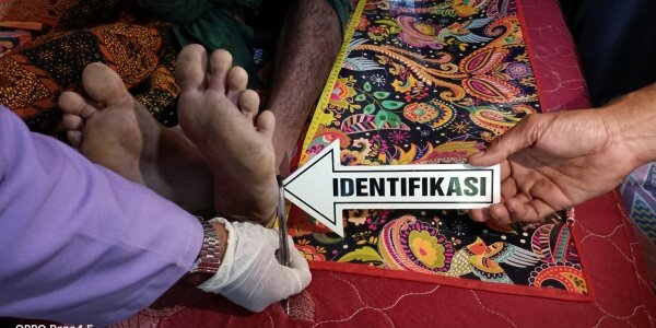 Depresi Akibat Ditinggal Istri, Pria di Wera Gantung Diri