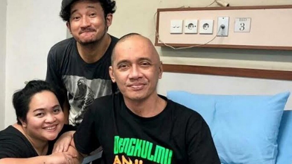 Komedian Agung Hercules Tutup Usia